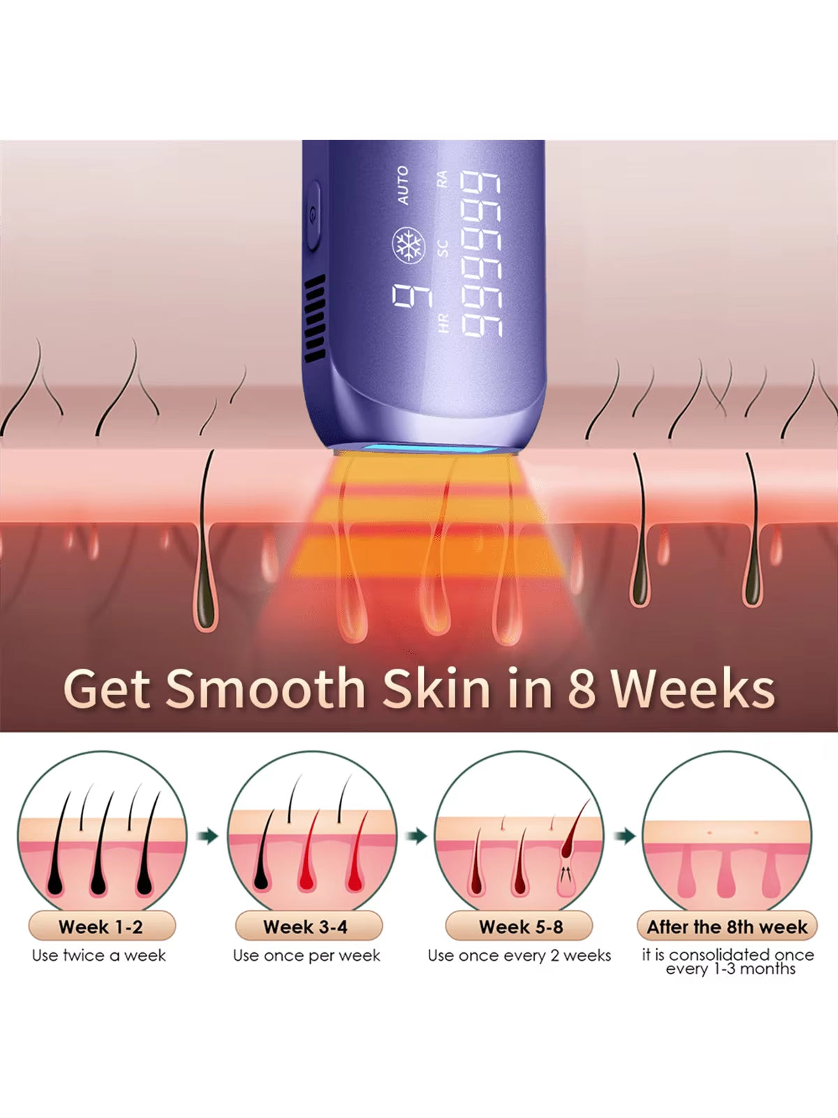 Linkify Portable IPL Laser Hair Removal Mobile Phone with Ice Cold, Laser Hair Removal Device