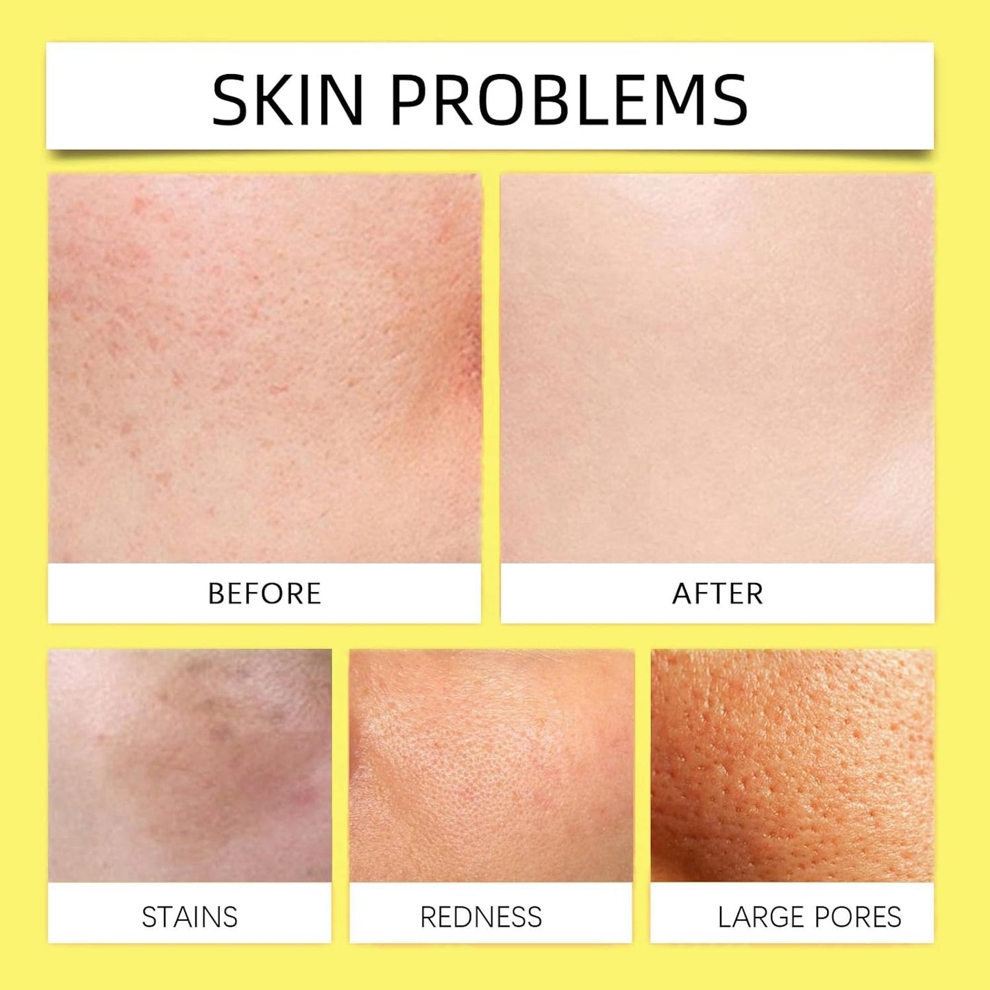Turmeric Kojic Acid Cleansing Pads,Face Cleansing Pads,10Pcs Turmeric Exfoliating Foaming Pads,Exfoliating Face Pads,Resurfacing Pads for Face & Body,Facial Sponges for Cleansing,Acne Face Wipes